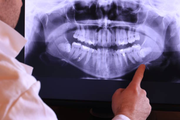 Best Emergency Dentist for Knocked-Out Tooth in Daniels, WV