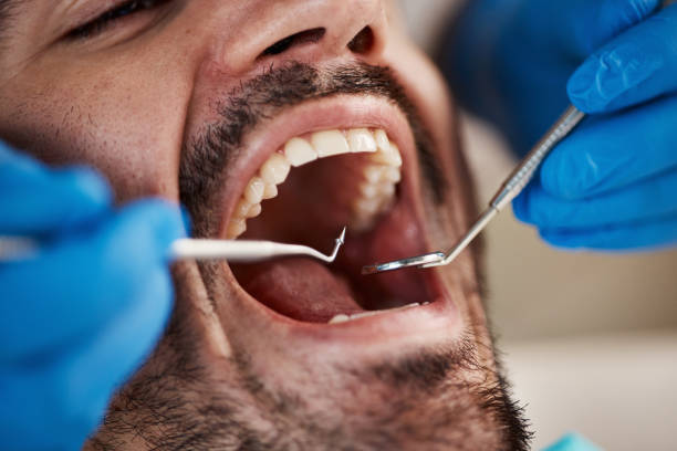 Best Broken or Cracked Tooth Emergency Dentist in Daniels, WV